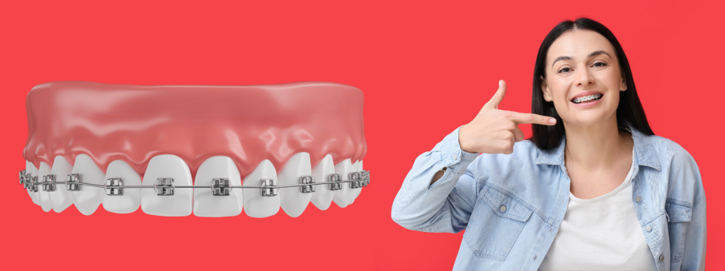 Dental Braces Treatment In Kolkata