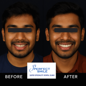 perfect smile Kolkata 1